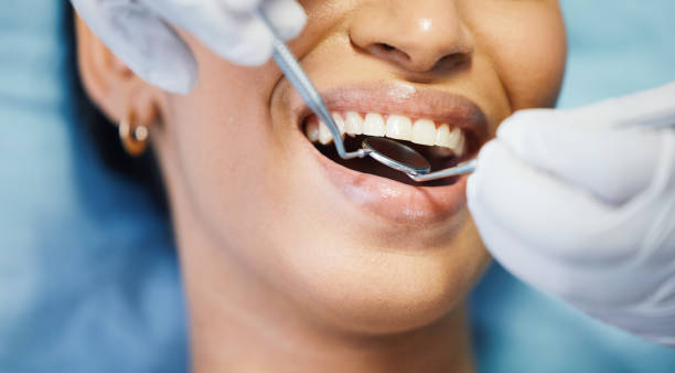 Best Emergency Dentist for Special Needs Patients in Bellefontaine, OH