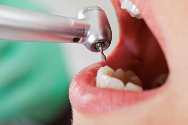 Best Emergency Cosmetic Dentistry in Bellefontaine, OH